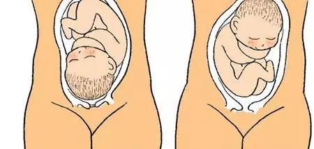 助孕公司哪家好