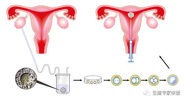 邯郸不育不孕医院