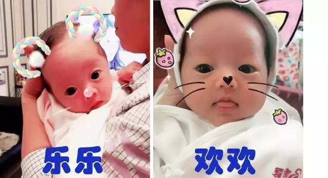 妇科不育不孕的检查